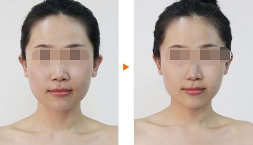 提升容貌魅力，輕松讓五官變立體