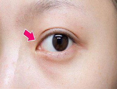 吸脂隆胸手術(shù)費(fèi)用及效果維持時(shí)間解析