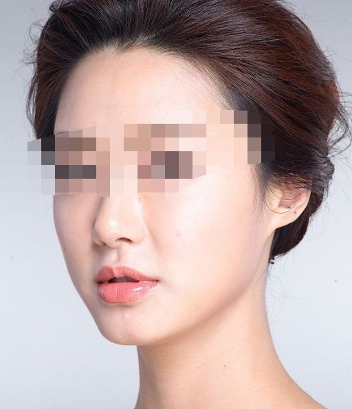 搶拍夏日纖體良方，四大瘦身法解析深度對(duì)比！