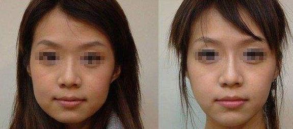 長期外眼角傷害視力？這樣保護眼睛更有效！