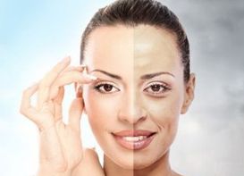 L型假體隆鼻持久度有多久？探討假體隆鼻效果持續(xù)時(shí)間