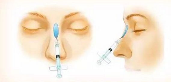 美白祛斑的方法有哪些？4種醫(yī)美美肌方案推薦