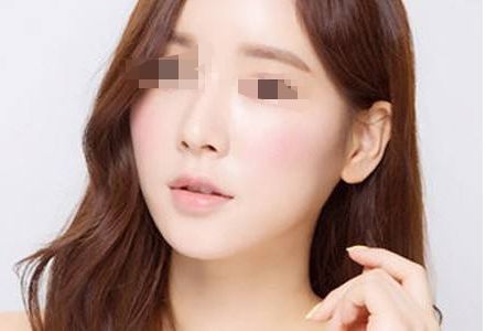 下頜角切除手術(shù)的注意事項及恢復(fù)方法