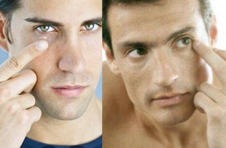 透明質(zhì)酸隆鼻短期內(nèi)是否適合桑拿？