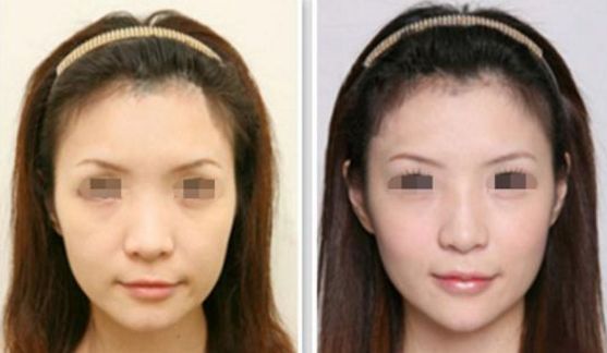 吉大二院種植牙價(jià)格及服務(wù)詳細(xì)解析