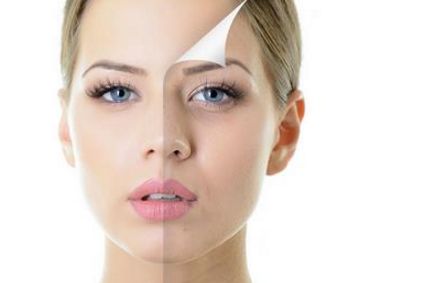 光子嫩膚安全性揭秘：效果持久且無副作用！