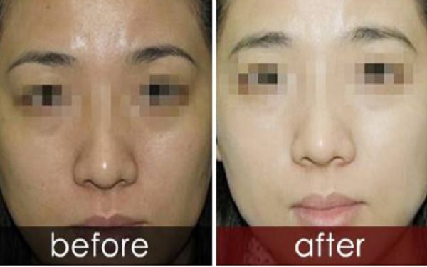 曬黑后如何迅速變白？曬黑美白需要持續(xù)護理多久結(jié)果可見？了解曬后護膚科普！