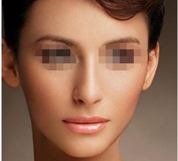 幼態(tài)臉緊致效果揭秘！填充劑真的消腫及維持時(shí)長(zhǎng)有保障嗎？整容前必讀！