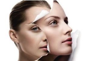 雙下巴吸脂手術(shù)的風(fēng)險(xiǎn)下降了嗎