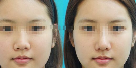 紀(jì)輝私人制造設(shè)備，安全可靠嗎？