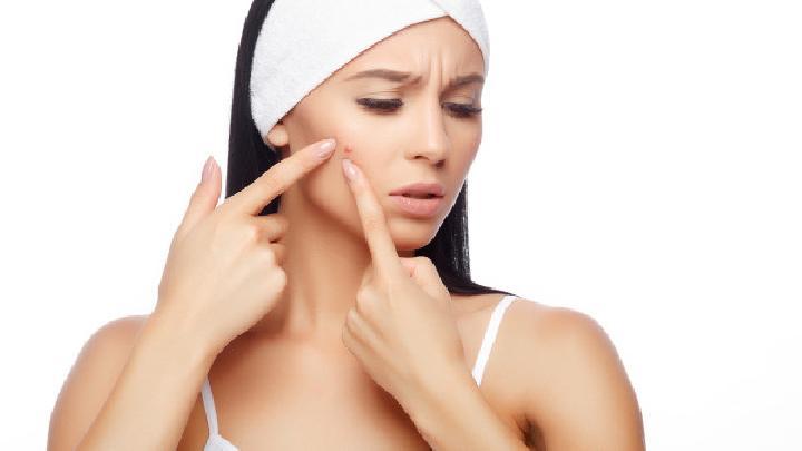 女生如何快速消除痘痘？祛痘的有效方法有哪些？