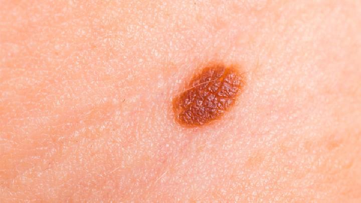 手把手教你制作巧克力牛奶美白面膜，效果超乎想象！