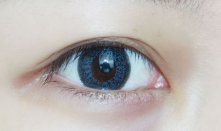 淮南市醫(yī)院有做雙眼皮手術(shù)嗎？手術(shù)技術(shù)如何？?jī)r(jià)格如何？實(shí)例解析給您參考