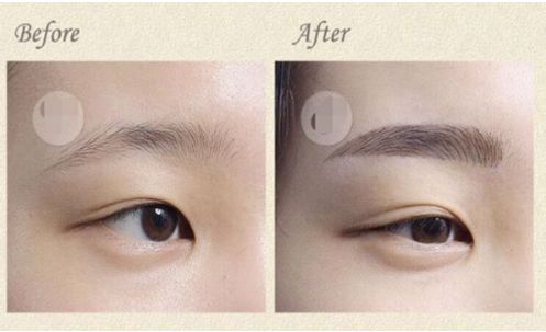 成都華西口腔種植牙費(fèi)用一覽表出爐！想了解非常受歡迎的五位醫(yī)生？