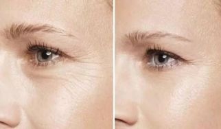 杭州哪家激光祛斑醫(yī)院靠譜？網(wǎng)友強推前五實力醫(yī)院