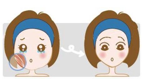 新疆整形醫(yī)院鼻部手術效果如何？預約掛號是否復雜？美麗鼻型展現(xiàn)，了解方法！