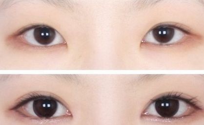 南京中醫(yī)院優(yōu)秀雙眼皮專家推薦，值得信賴！完善的醫(yī)生介紹、項目介紹及價格表供參考