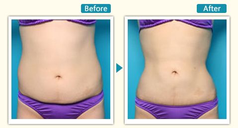 2023年長(zhǎng)沙地區(qū)整容醫(yī)院排行榜揭曉，封面醫(yī)學(xué)機(jī)構(gòu)信息一覽