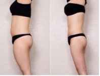 上海長征醫(yī)院引領(lǐng)植發(fā)領(lǐng)域，李宇飛頗受好評，專家名單曝光！