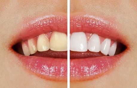 榆林市第一醫(yī)院最牛眼科專家曝光！秒懂近視眼手術真相