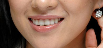 探尋西安藝星宋蔚雙眼皮技術(shù)，深度解析醫(yī)生實(shí)力與經(jīng)典案例分享