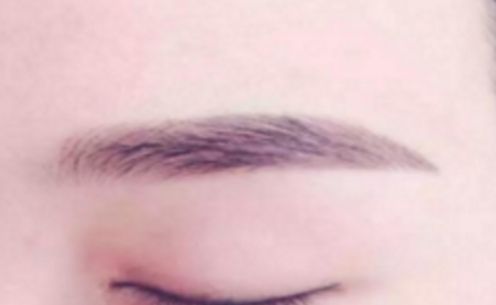 附近哪家醫(yī)院可以提供恩施的自體墊鼻尖手術(shù)？看看全新的隆鼻價(jià)格列表