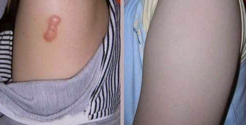 天津河?xùn)|美萊醫(yī)學(xué)醫(yī)院受推崇的全雙醫(yī)生吸脂術(shù)是否靠譜？