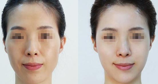 南寧亞太整形醫(yī)院：專家云集，口碑相傳