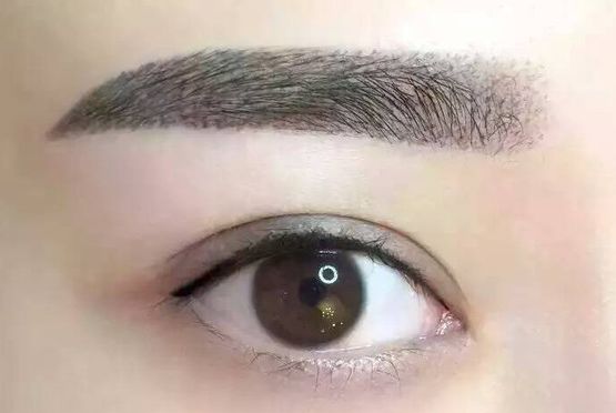 喬軍醫(yī)生眼部整形手術(shù)能力如何？詳解醫(yī)生經(jīng)歷與成功案例