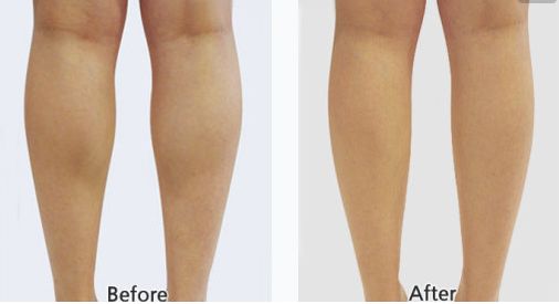 哪家醫(yī)院在武漢做自體脂肪隆胸效果好仁愛時(shí)光、藝星、華美等TOP5可選~