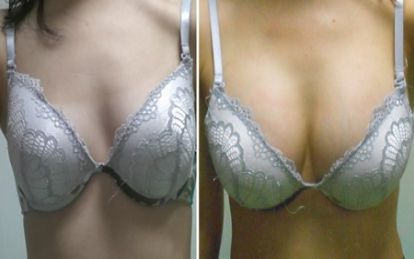 2023年推薦的專業(yè)北京地區(qū)鼻部修復(fù)醫(yī)療中心排行榜