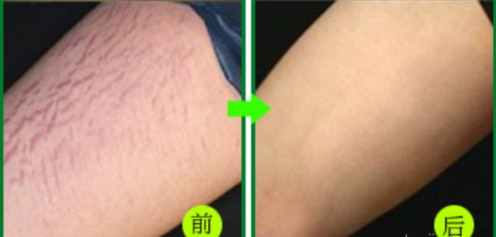 杭州地道整形好醫(yī)院推薦，當(dāng)?shù)鼐用窳λ]的高水平醫(yī)療機(jī)構(gòu)