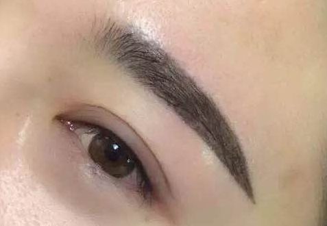 華西卿勇隆鼻技術(shù)體驗分享：醫(yī)生實力評述及效果圖展示！