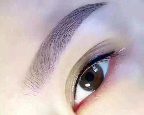 孟慶鵬最新鼻部整形手術(shù)效果怎么樣？贊譽(yù)無數(shù)的醫(yī)生評價+手術(shù)案例分享！鄭州uu們必看~