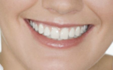 貴陽美貝爾錢剛技術(shù)的用戶評價和玻尿酸隆鼻案例分享