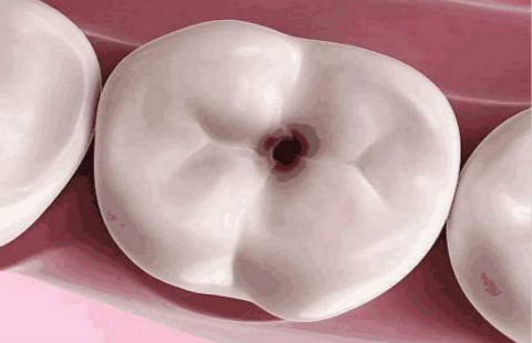 滄州有哪些醫(yī)院可以信賴(lài)進(jìn)行開(kāi)眼角手術(shù)？如何選擇更適合自己的醫(yī)院？