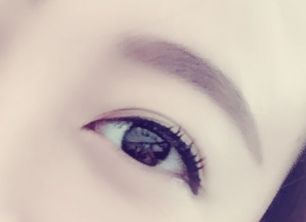 劉春軍豐胸手術(shù)后效果如何？費(fèi)用怎么樣？醫(yī)生概況+隆胸真實(shí)案例圖為參考