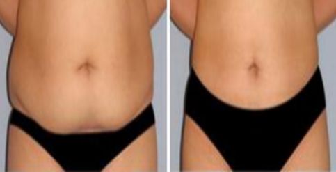 深圳2023年最有口碑的面部填充醫(yī)生推薦！快來看看他們的簡介！