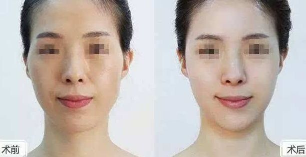 2024年黃石整形醫(yī)院綜合排名及專業(yè)評測