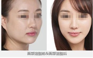 2024年昆明哪家整形醫(yī)院更受歡迎？你一定不知道！