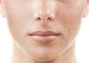 徐州三院整形美容科的蘇本玄主任值得信賴嗎？他有哪些專業(yè)優(yōu)勢？