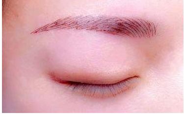 深圳醫(yī)生劉冰的鼻子整形效果如何？專業(yè)實(shí)力及成功案例發(fā)布