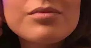 2023北京八大處醫(yī)院雙眼皮手術(shù)醫(yī)生榜單揭曉，楊明勇、王佳琦、靳小雷等醫(yī)師備受好評(píng)！