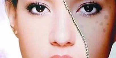 上海眼部修復(fù)專家推薦，治療眼部問(wèn)題可信賴！