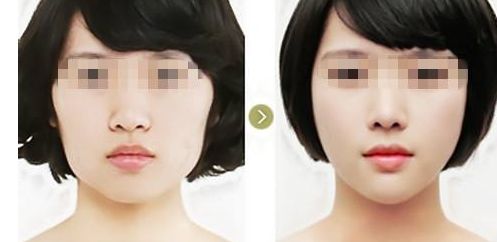 廈門哪家醫(yī)美醫(yī)院口碑最好？專業(yè)特色診療機構一覽