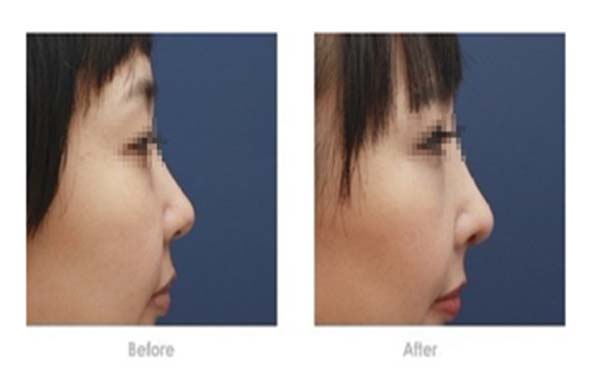 熱門的吉林眼修復(fù)醫(yī)院有哪些這些醫(yī)院的眼修復(fù)效果如何呢