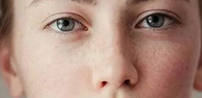 深圳鵬愛整形術后效果如何？胸部隆胸手術案例分享