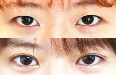 蚌埠醫(yī)學(xué)院第一附屬醫(yī)院眼科權(quán)威專家推薦！