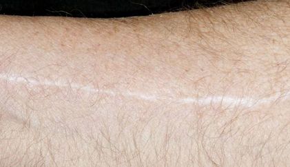 《青島王醫(yī)生的雙眼皮手術效果如何？專業(yè)簡介與真實案例分享》