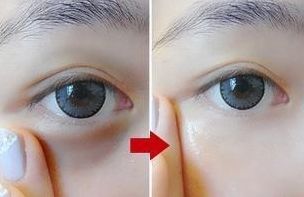 南通人民醫(yī)院眼科專家團(tuán)隊(duì)露面！這5位備受好評(píng)的專家赫然名列其中